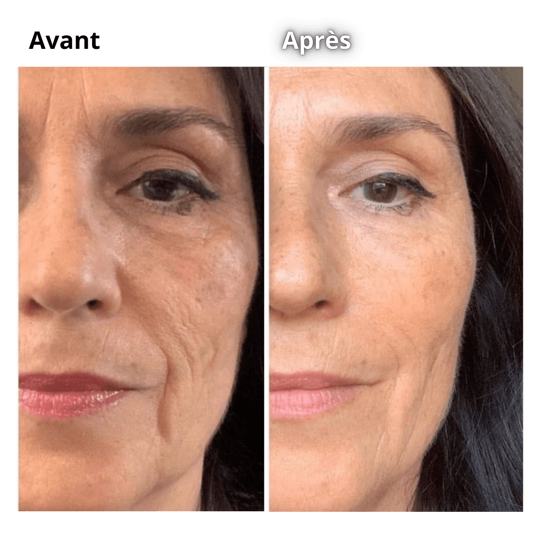 Modaréa Dermalight Rouge™