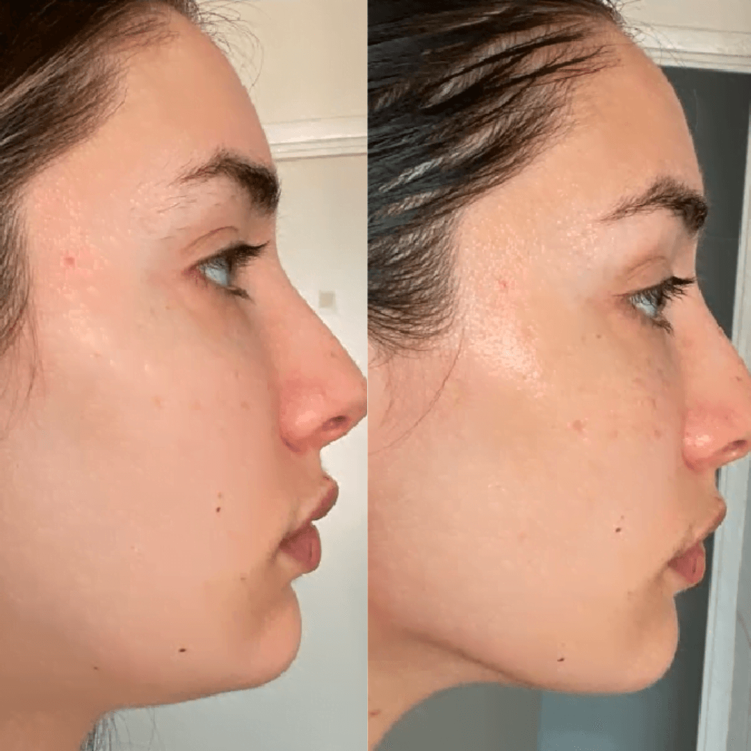 Face Lift Pro™ – Raffermit & rajeunit instantanément