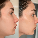 Face Lift Pro™ – Raffermit & rajeunit instantanément