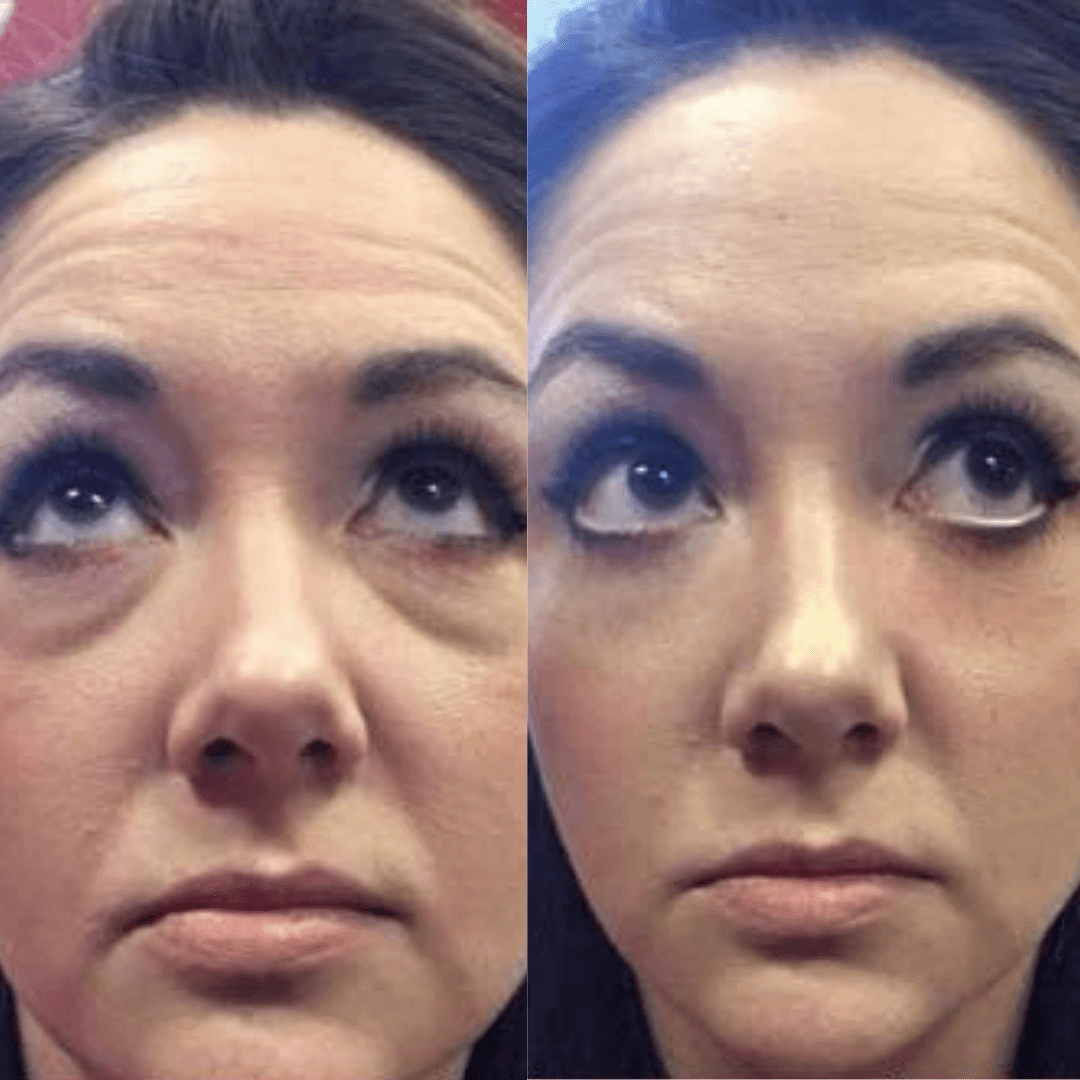 Face Lift Pro™ – Raffermit & rajeunit instantanément