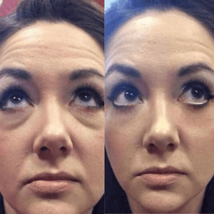Face Lift Pro™ – Raffermit & rajeunit instantanément